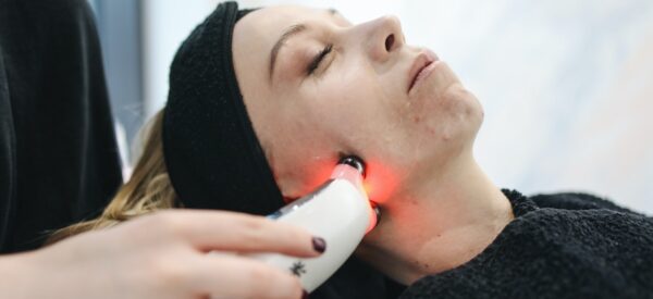 acne laser treatments